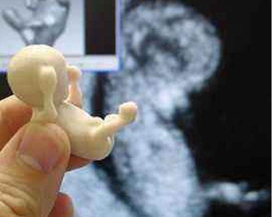 人工流产胎儿医院怎么处理,人工流产胎儿最后如何处置