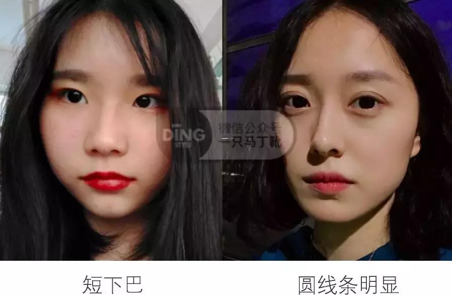 中庭又长又宽显老,中庭长怎么避免显老