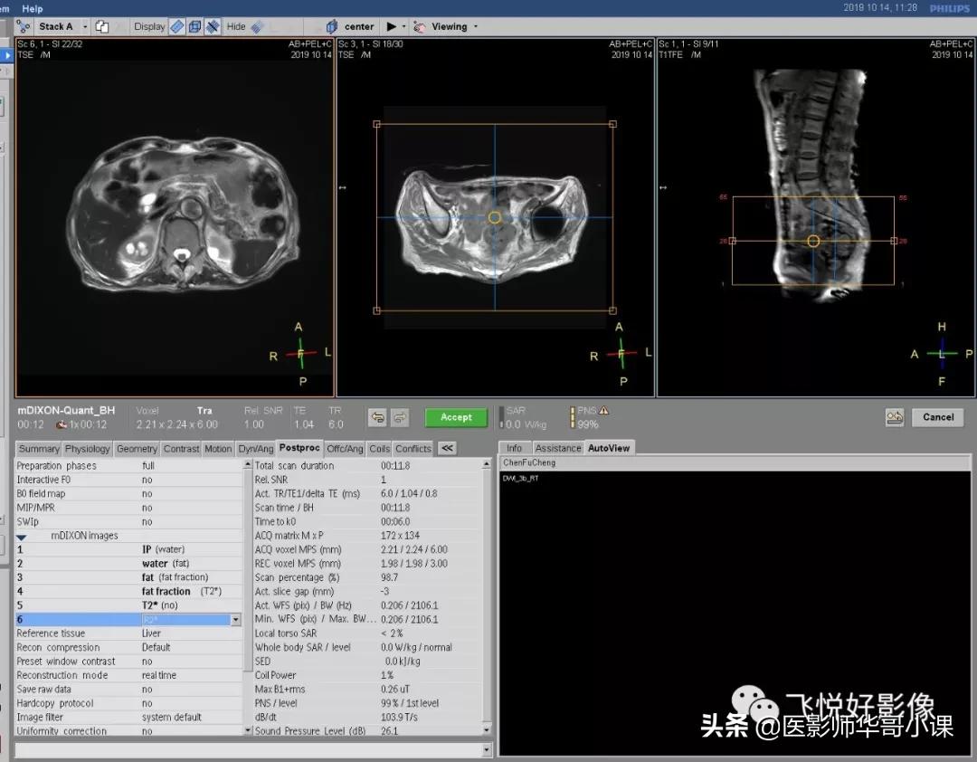 飞利浦磁共振快速扫描方案指南,飞利浦1.5t磁共振各部位扫描技术