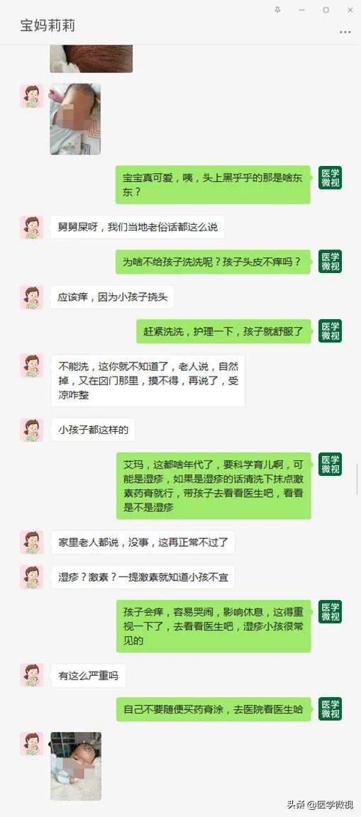 宝妈出现湿疹,宝妈一定要警惕3大湿疹误区