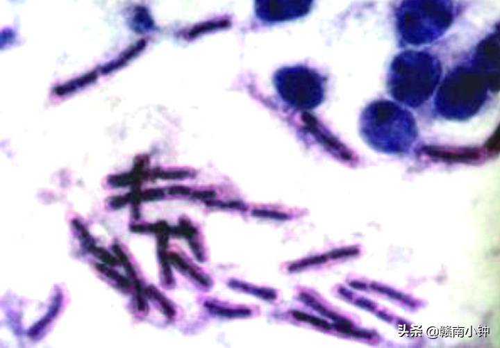 山羊疾病预防药,山羊巴氏杆菌治疗方法