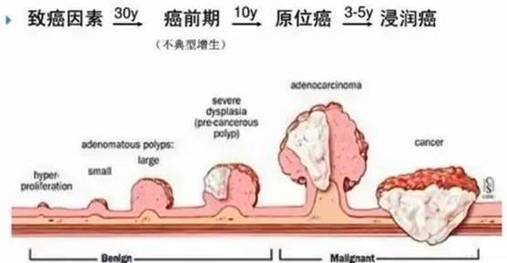 结直肠腺瘤是癌吗？肠腺瘤该如何治疗？