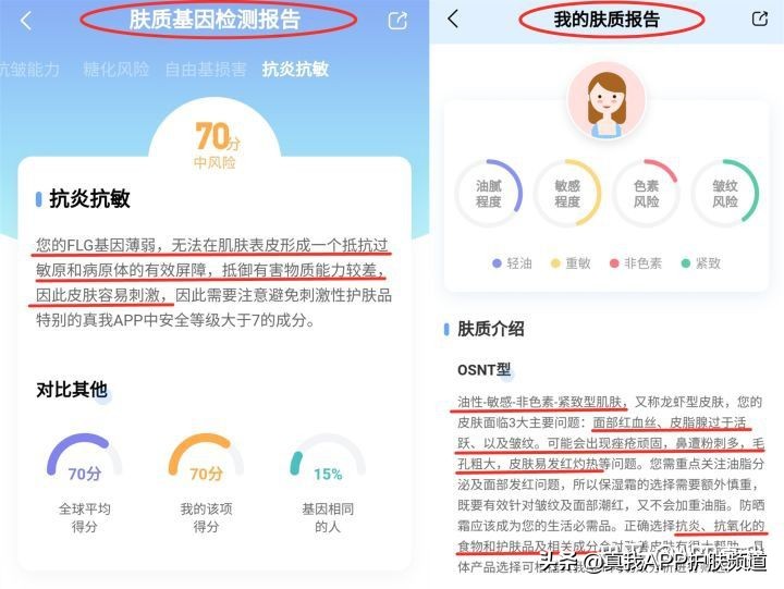 原来长痘痘有这么多的烦恼,长痘痘到底有多烦恼