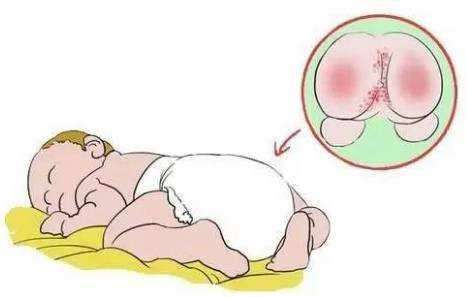 月嫂吐露婴儿各种常见问题大揭秘,月嫂应该知道宝宝为什么哭么
