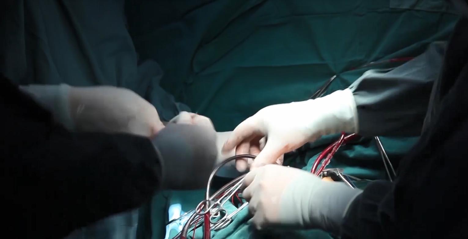 真实案例：警惕建筑材料中致病因素！患者3.9cm甲状腺结节已融合