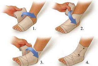 脚踝扭伤一个月了还肿疼痛正常吗,脚踝扭伤肿胀疼痛用什么药