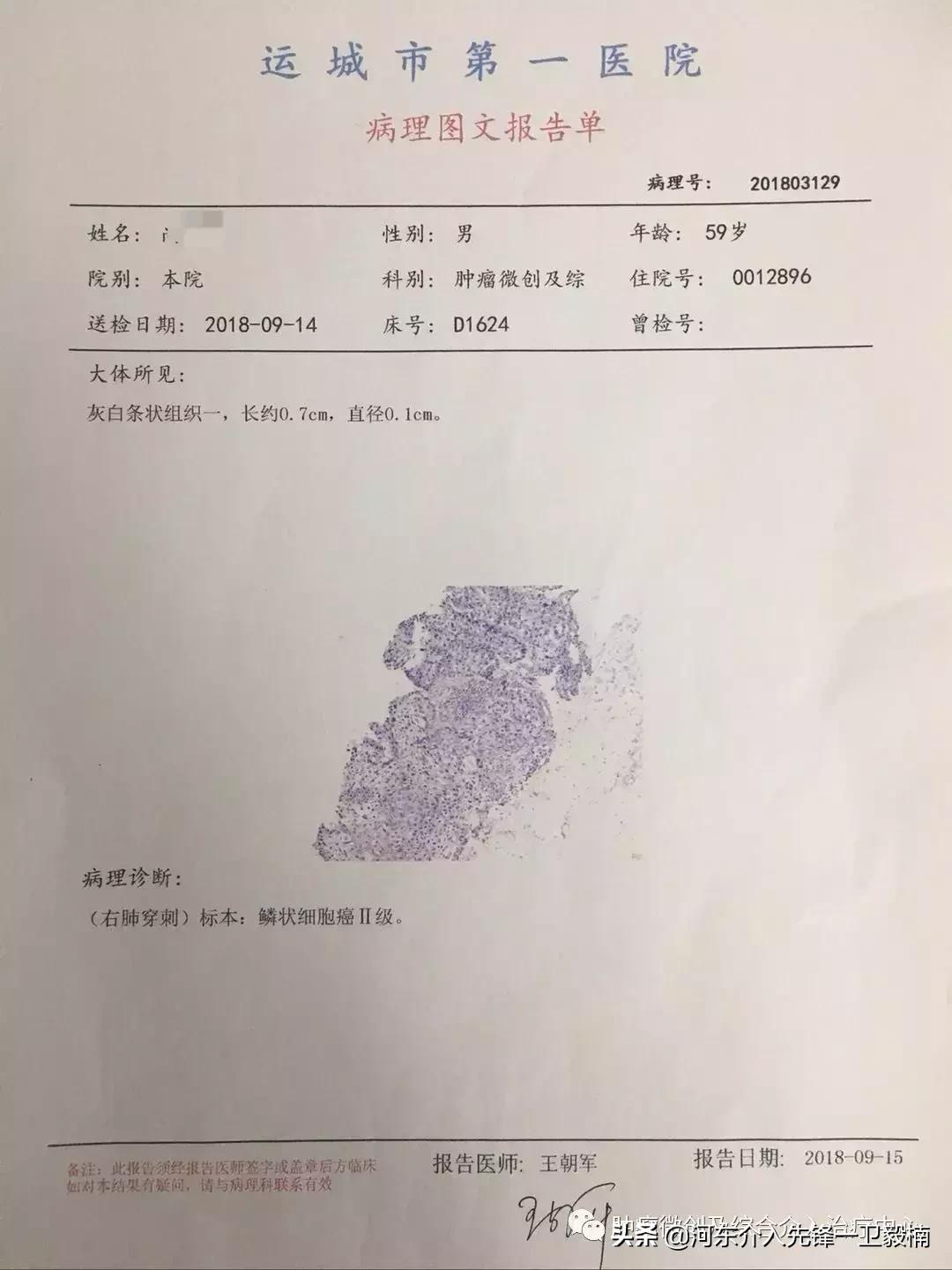 肺癌诊断与微创综合治疗,肺癌晚期的微创介入治疗