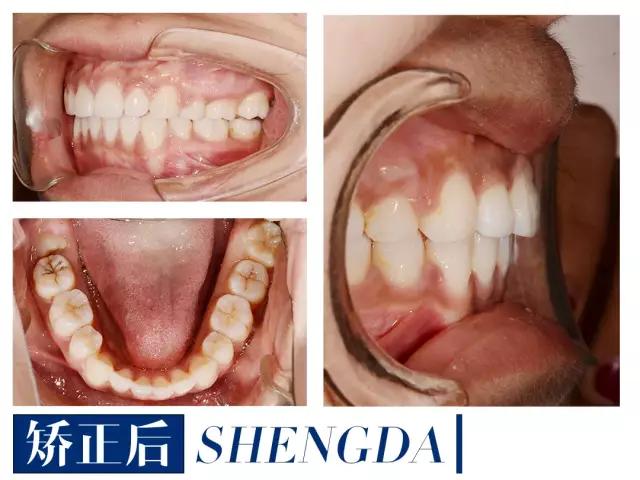 山西“爱马仕”级别齿科医院!get明星同款笑容