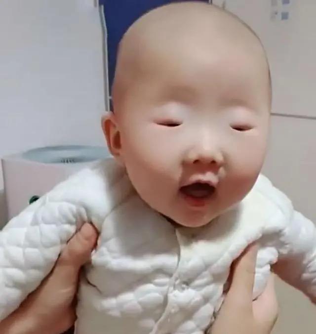 宝宝眼睛太小妈妈误认为没了,宝宝眼睛太小走红
