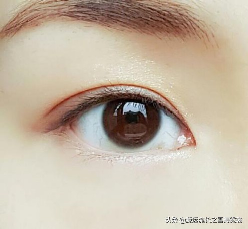 单眼皮双眼皮的区别,单眼皮双眼皮