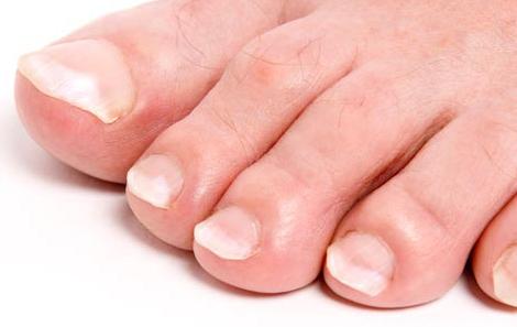 脚上有病有什么征兆,脚上有这三种症状赶紧去医院