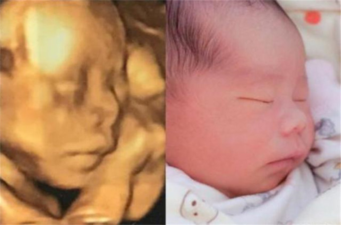 宝宝四维照片和生下来照片对比,四维照片所有宝宝都长得一样吗