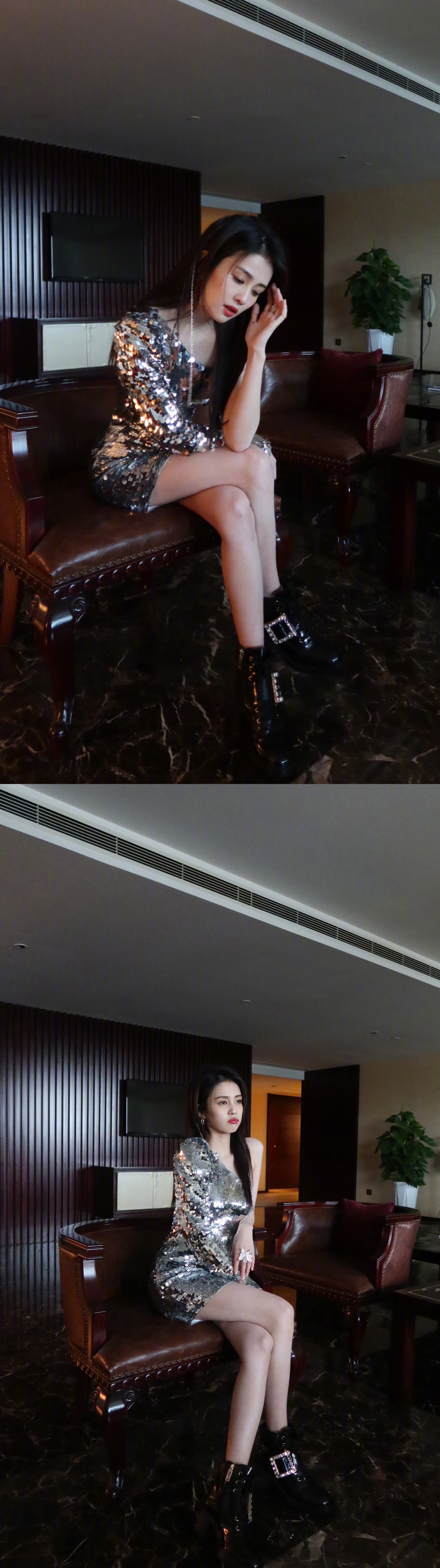 女生膝盖上的淤青是怎么造成的,女生的膝盖上总有淤青是什么原因