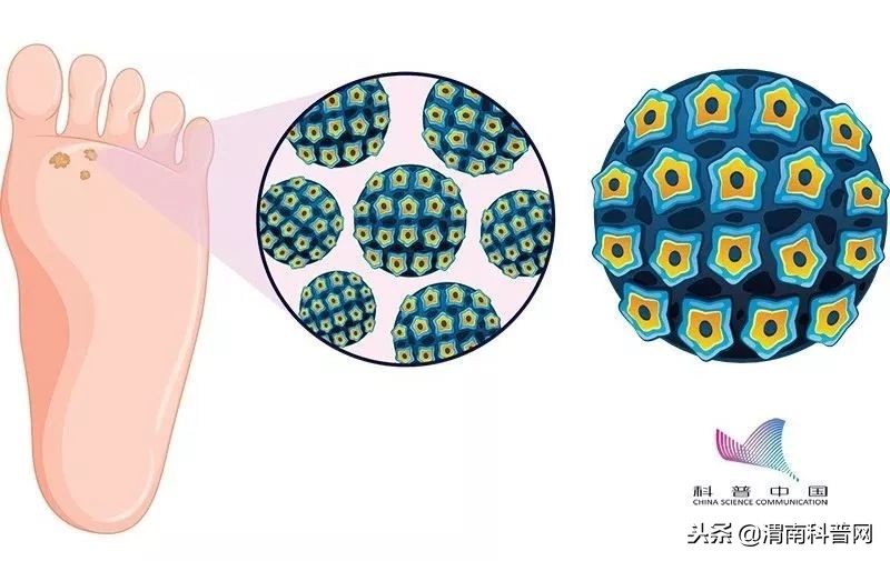 真菌是怎么感染动物的,真菌是怎么感染虫子的