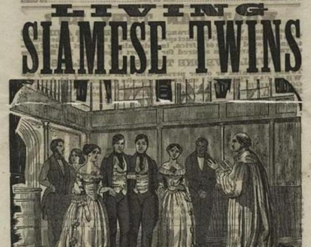 连体人是如何结婚生子呢,连体人结婚生了孩子是什么样子