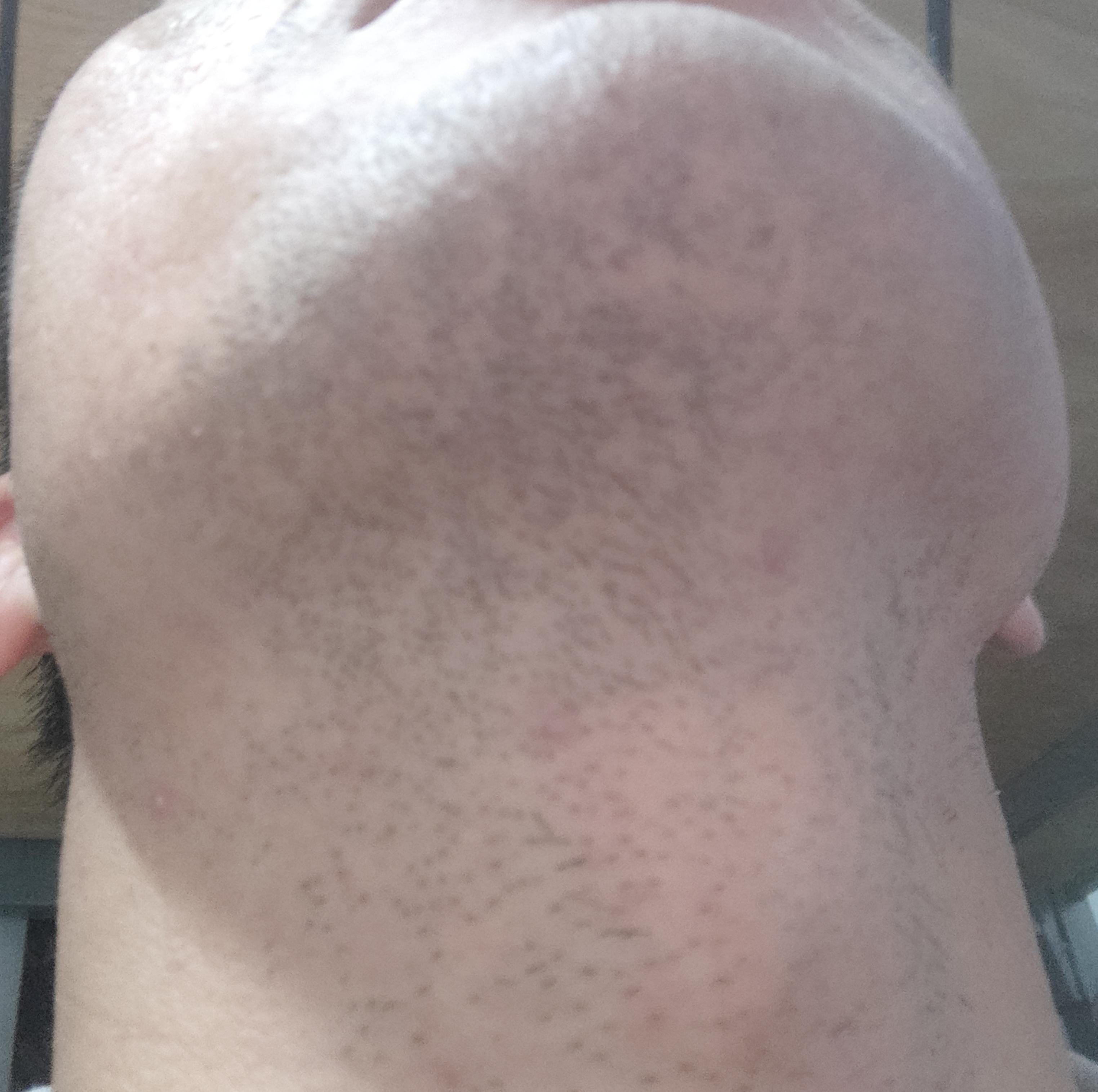 剃须刀选手动的还是电动的,手动剃须刀的使用视频