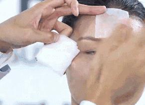 闭口反反复复长到底怎样才能根治,闭口反反复复长怎么办