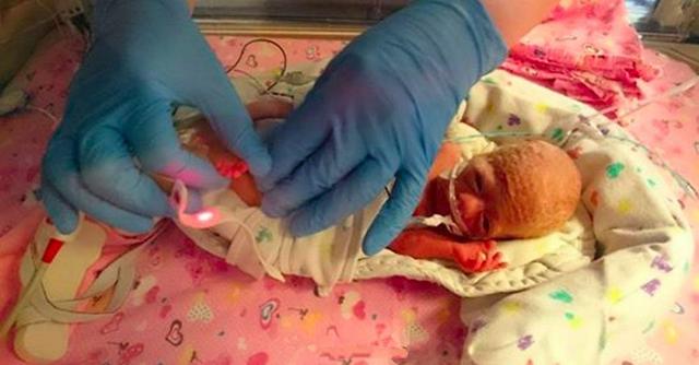 3.7斤早产儿终于长大了,早产儿从3.5斤长到4斤大概要好久