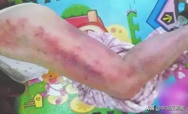 8岁男孩抢救无效身亡后续,小孩抢救无效丧命