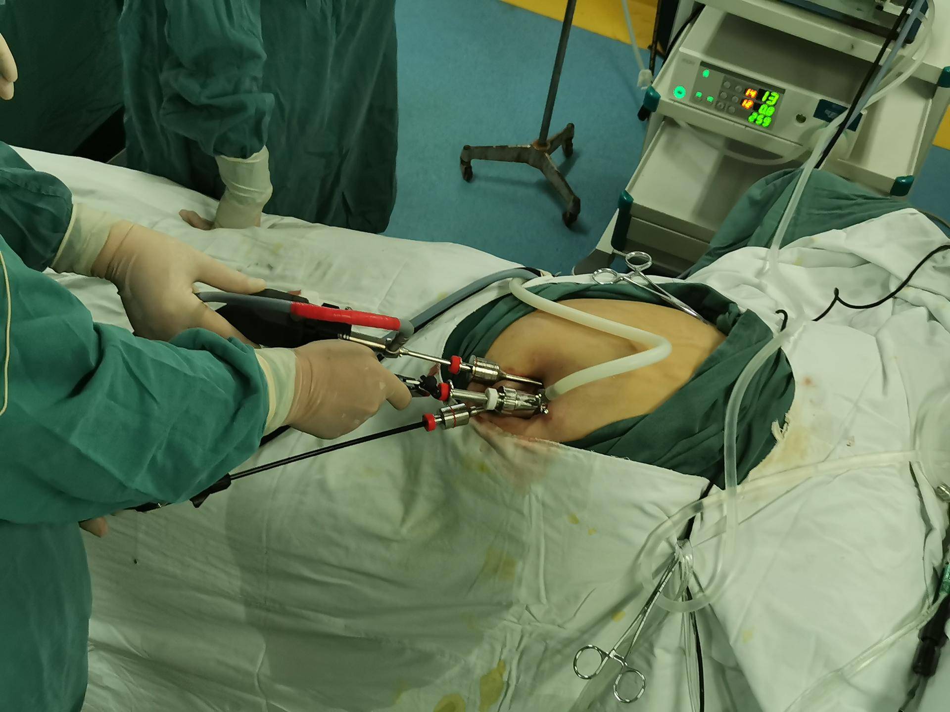 手术麻醉过后会影响智力?留后遗症?医生来告诉你真相