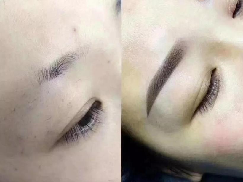 深圳传奇光学科技美容,深圳传奇光学祛斑仪器