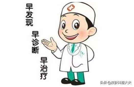 一脸褐斑怎么办,得了紫斑严重吗