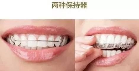 牙齿矫正后隐形保持器佩戴方法,牙齿矫正保持器必须24小时佩戴吗