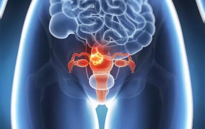 卵巢怎么保养吃什么补卵巢功能,四十岁女人卵巢早衰如何保养