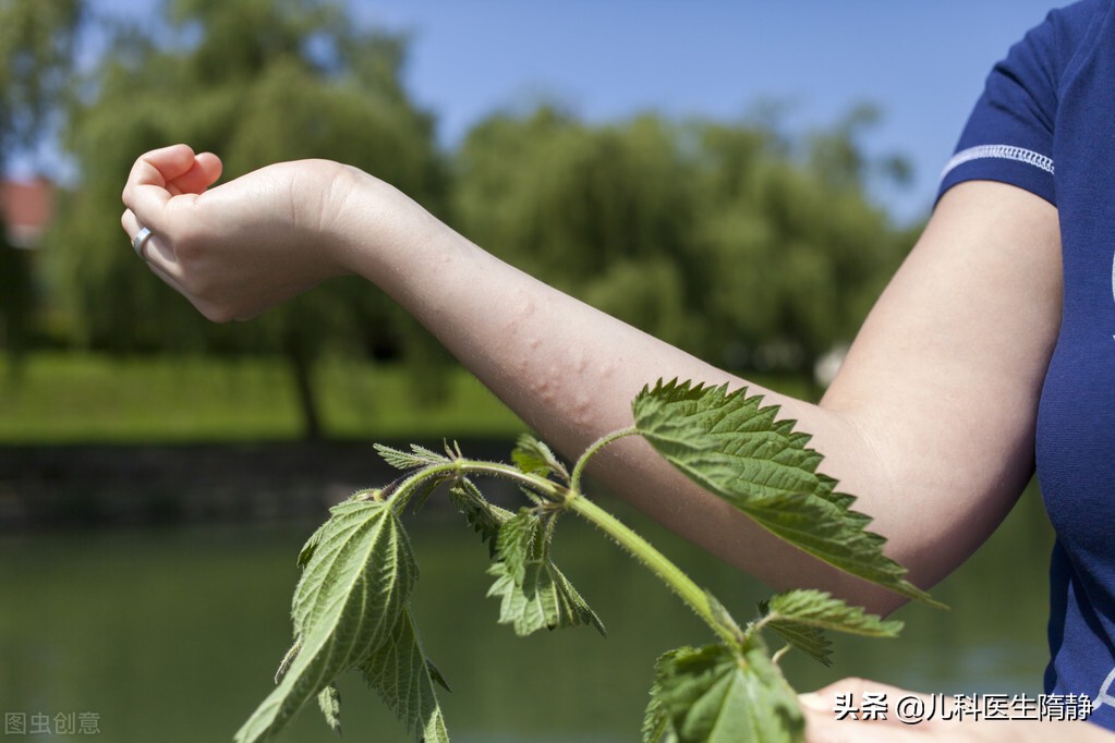 周身起风团的原因,春夏季皮肤一热就发痒不红不肿