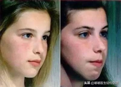 双胞胎姐姐长歪了！只因她用错呼吸方式!