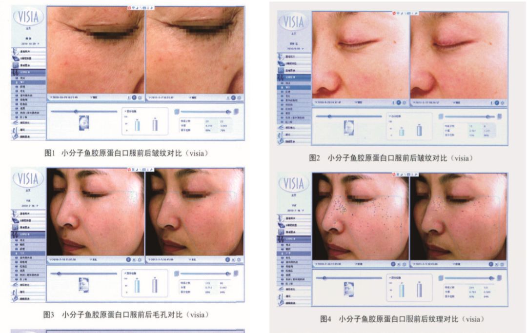 胶原蛋白流失该怎么补充胶原蛋白,胶原蛋白是如何流失