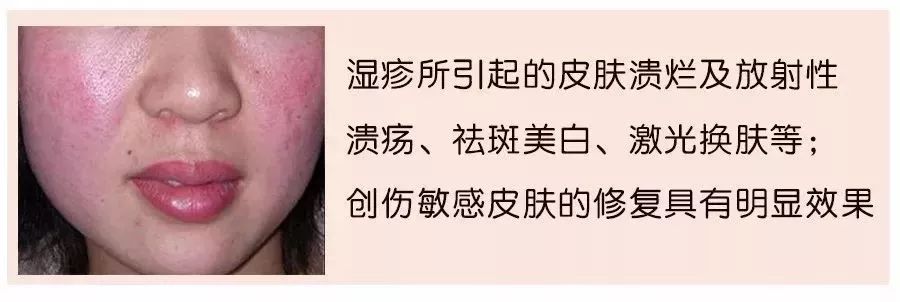 干粉冷冻,冷冻干粉的作用和功效