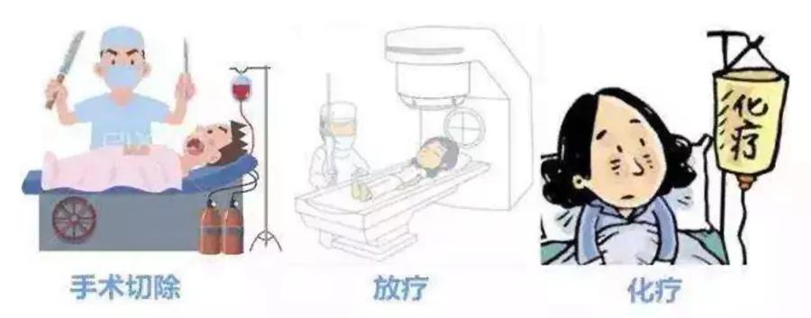 宫颈癌放疗25次全部费用,宫颈癌放疗的副作用有哪些