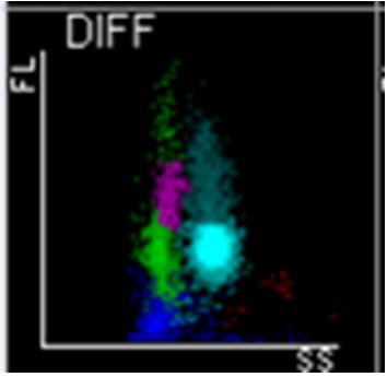 艾滋携带者的血常规,血常规可以发现艾滋么