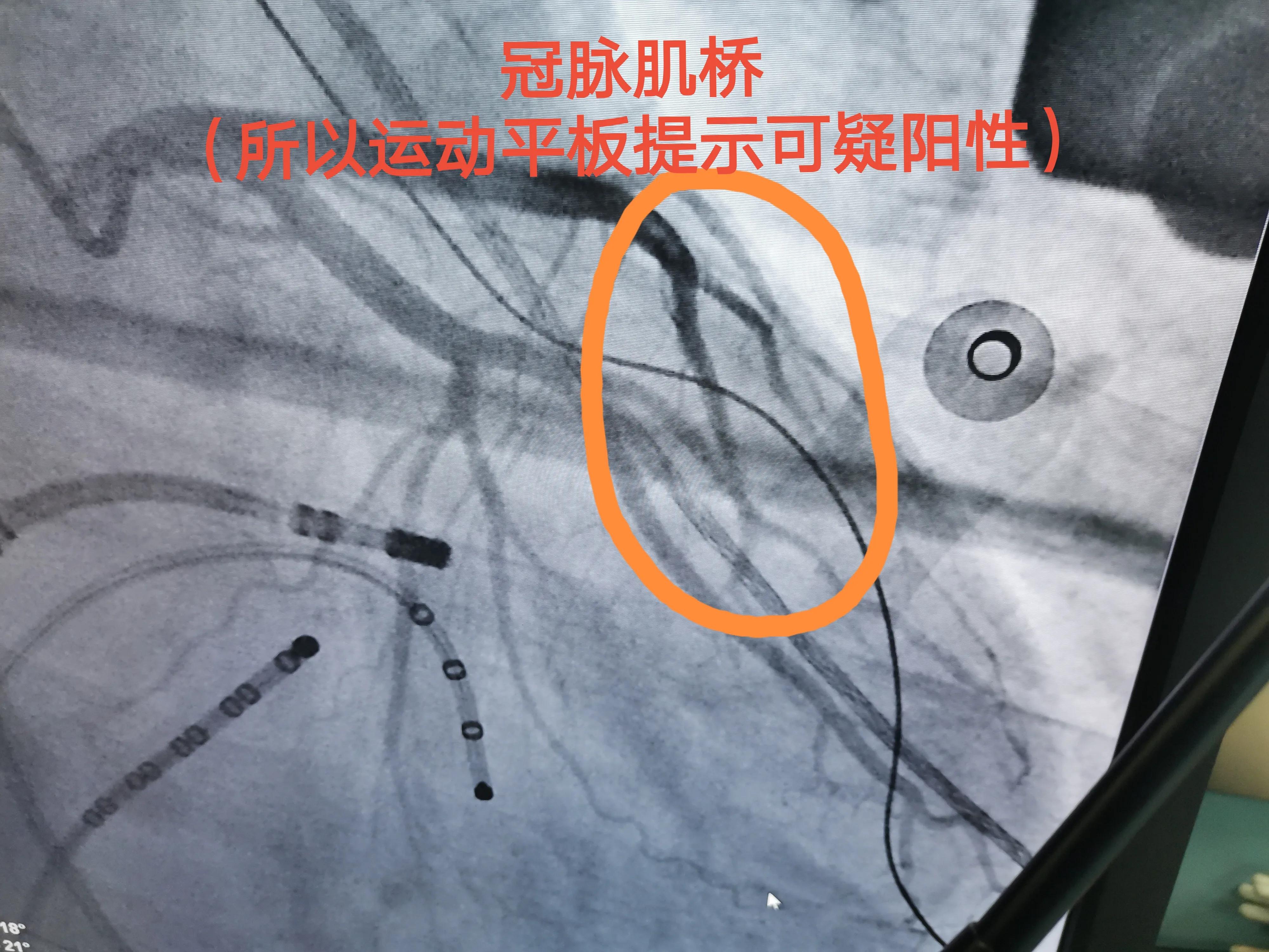 缁欒繙鍦ㄤ粬涔＄殑缃戝弸鎯呬功,缁欒繙鍦ㄤ粬涔＄殑缃戝弸瀵勪粈涔堢ぜ鐗╁ソ
