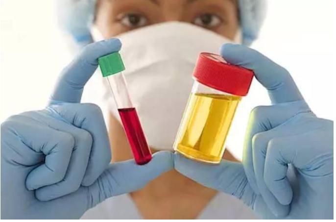 男性上厕所有褐色血是怎么回事,男性尿酸高的原因和危害有哪些