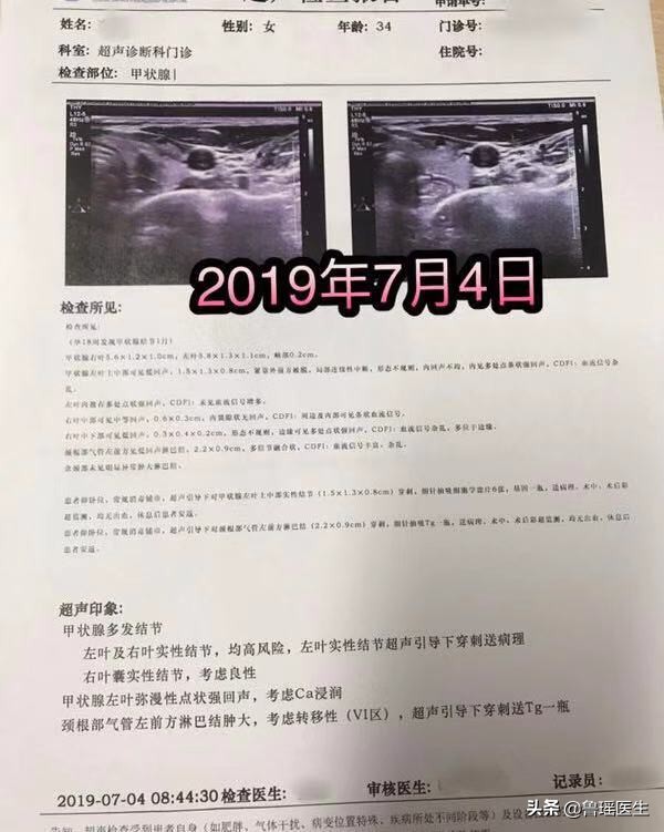 甲状腺癌手术后发现怀孕了能要吗,怀孕期间发现甲状腺癌