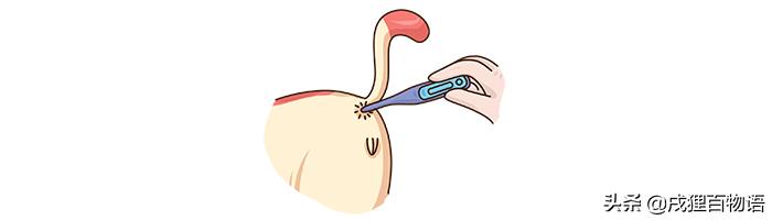 猫咪屁屁老是有稀便便是怎么回事,如何从猫咪便便判断是否生病