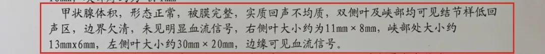 看懂化验单判断甲状腺结节良恶性,甲状腺结节微创和开刀的区别