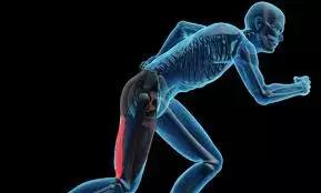 腘绳肌二级拉伤和三级拉伤的区别,大腿内侧拉伤韧带