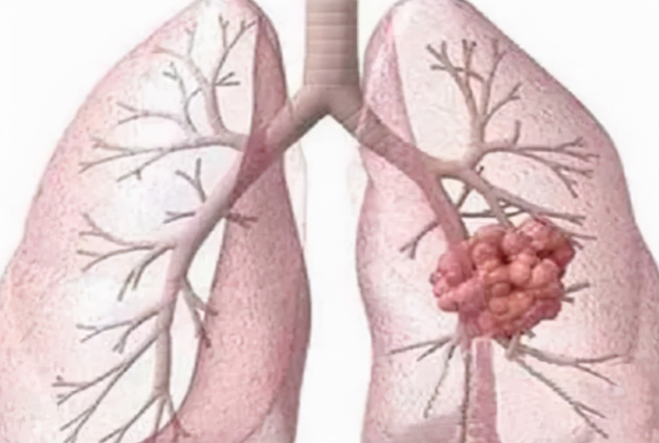 好消息九种病可以免费治疗,这8种病目前根本无法治愈