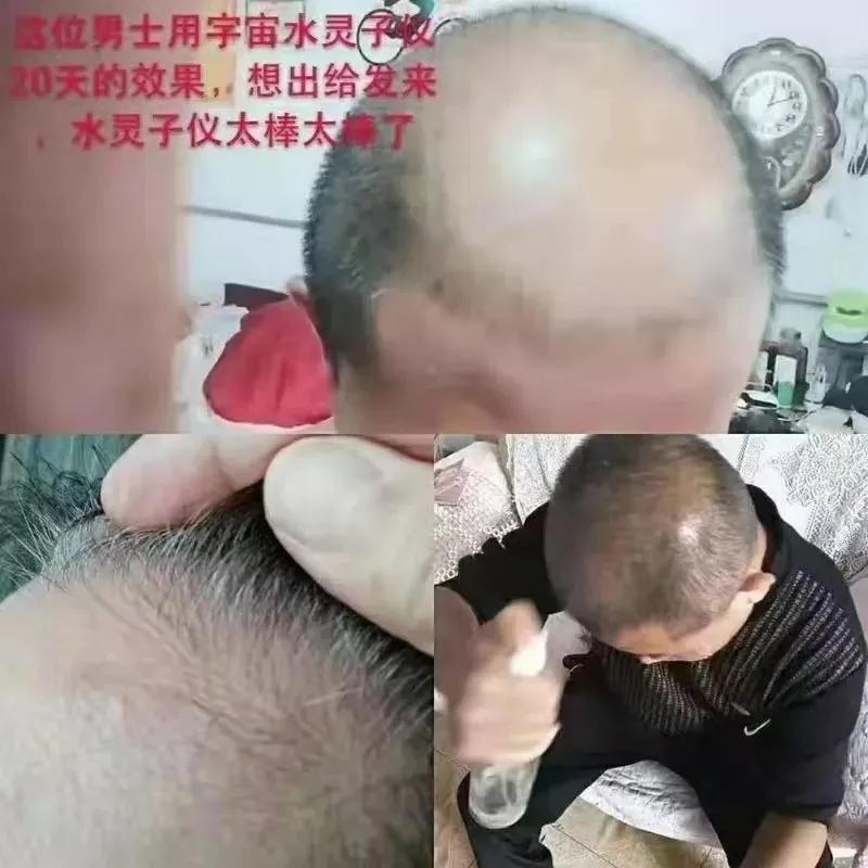 不锈钢做的仪器能治病？青岛宇宙水灵子涉嫌虚假宣传