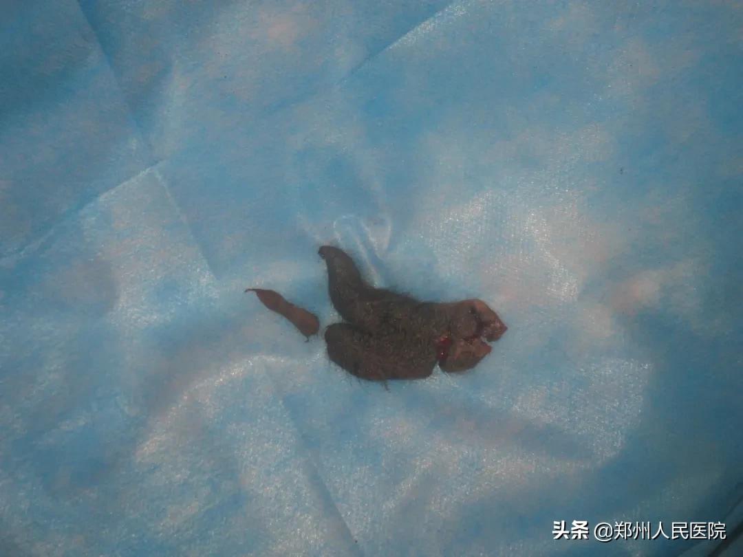 u1s1重要性,u1s1左手能力