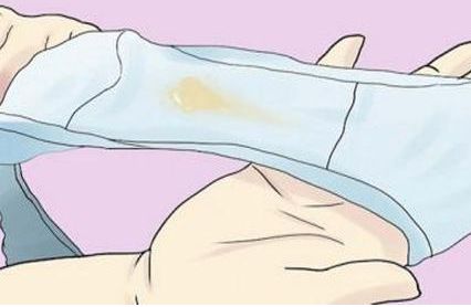 女性要知道的白带知识,白带的实质是什么