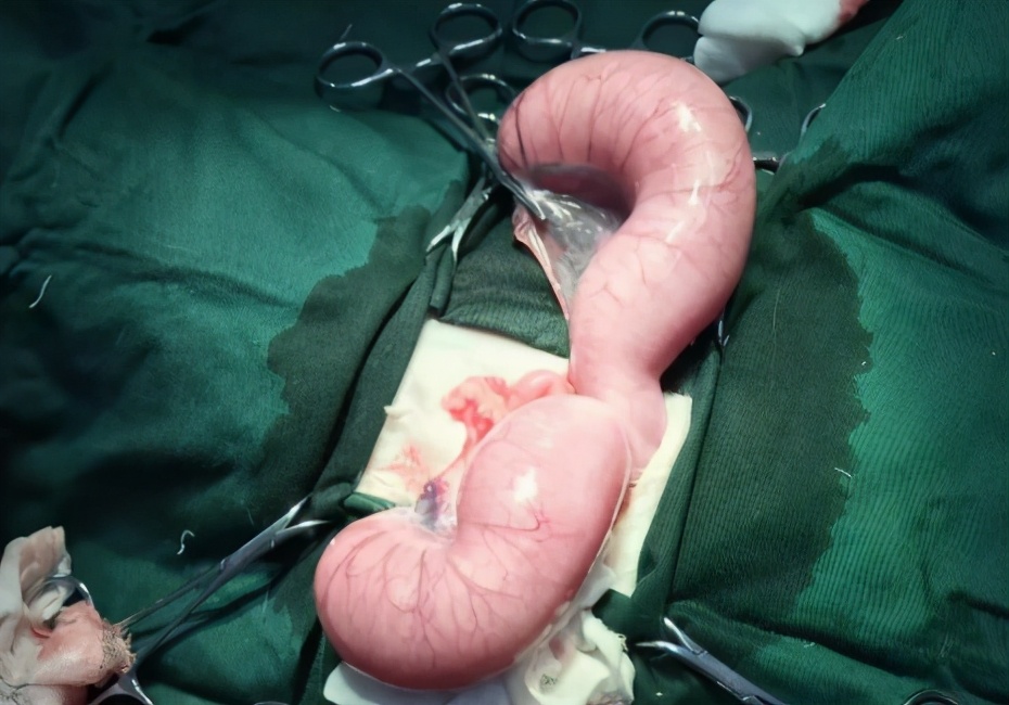 狗:我一次恋爱都没谈,居然得了这种病