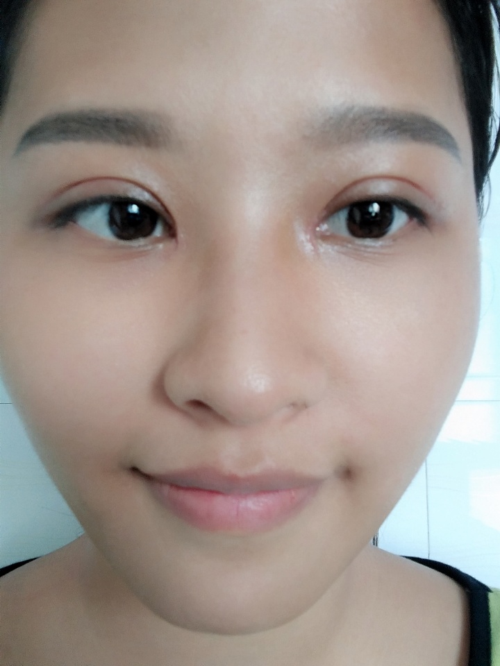 韩美做双眼皮,南昌韩美医院做双眼皮怎么样