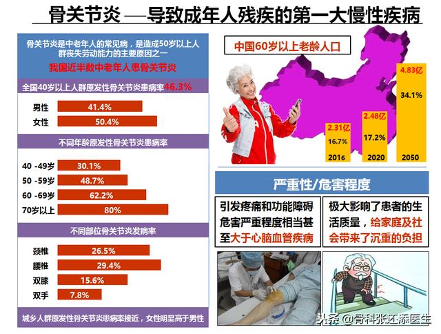 氨糖软骨素对骨关节好吗,关节炎吃氨糖和软骨素