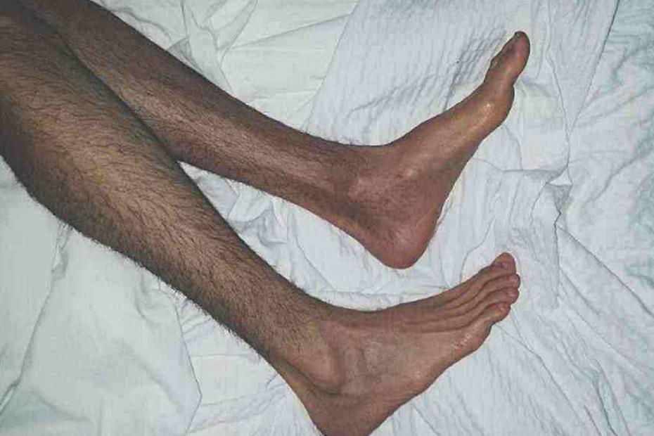 小米官方脱毛仪,小米冰点脱毛仪测评