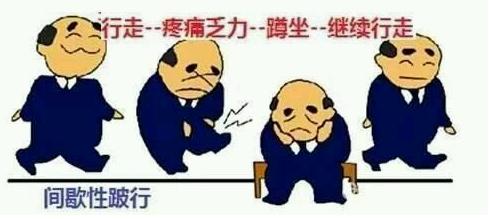 腰椎管狭窄一定要手术吗,严重的腰椎管狭窄必须手术治疗吗