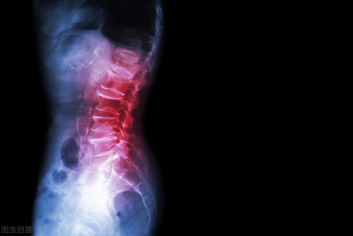 颈椎病会引起脖子和锁骨不舒服吗,脖子不舒服是颈椎病吗